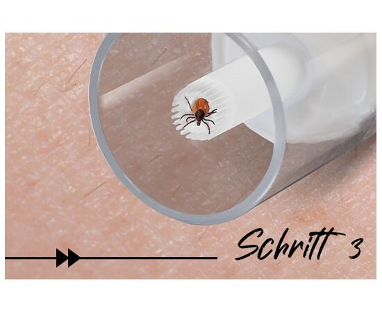 Zeckendreher für Menschen – Zecken sicher entfernen Schritt3 | imFUTTERSACK